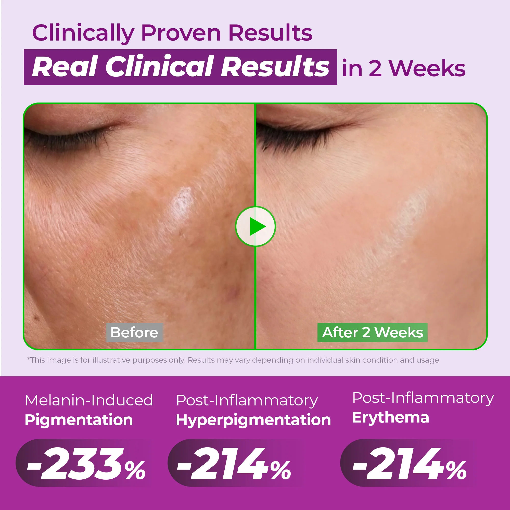 ALL (Sales Excluded)